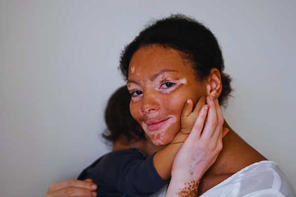 Portrait of a mother and child sharing a tender moment, representing the bond between generations and the importance of understanding inherited genetic conditions in family health.