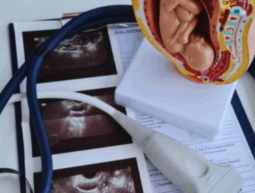 Hospital sonogram showing a pregnant mother and developing baby during an ultrasound scan, illustrating prenatal screening methods including NIPT and ultrasound.