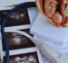 NIPT and Ultrasound: Why Expectant Moms Need Both Tests for Comprehensive Prenatal Screening