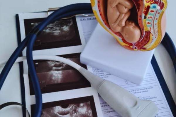 Hospital sonogram showing a pregnant mother and developing baby during an ultrasound scan, illustrating prenatal screening methods including NIPT and ultrasound.